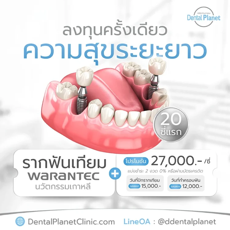 ราคารากฟันเทียม เกาหลี 2026